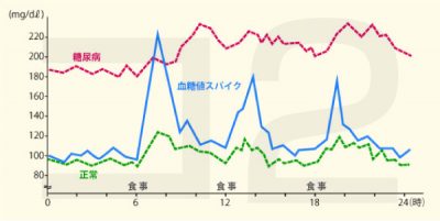 リッキーガット図版